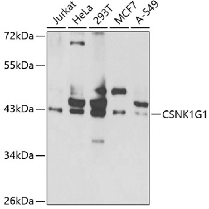CSNK1G1 Rabbit Polyclonal Antibody