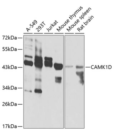 CAMK1D Rabbit Polyclonal Antibody