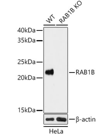 RAB1B Rabbit Polyclonal Antibody [KO Validated]