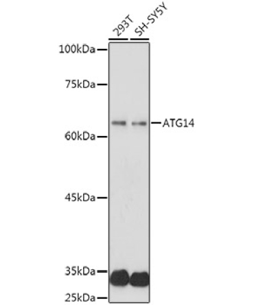 ATG14 Rabbit Polyclonal Antibody