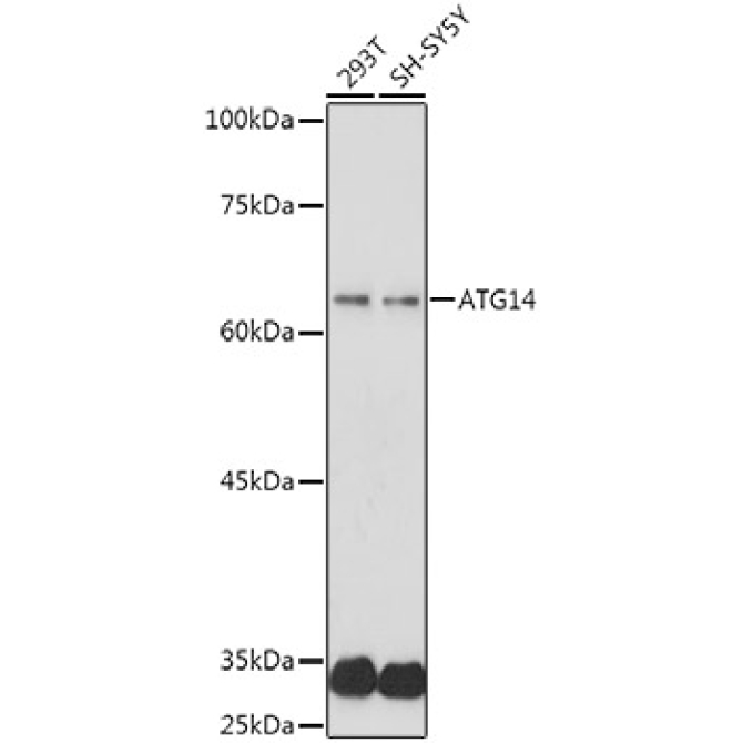 ATG14 Rabbit Polyclonal Antibody