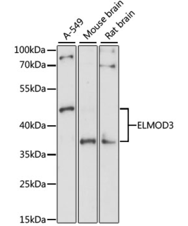 ELMOD3 Rabbit Polyclonal Antibody