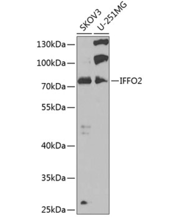 IFFO2 Rabbit Polyclonal Antibody