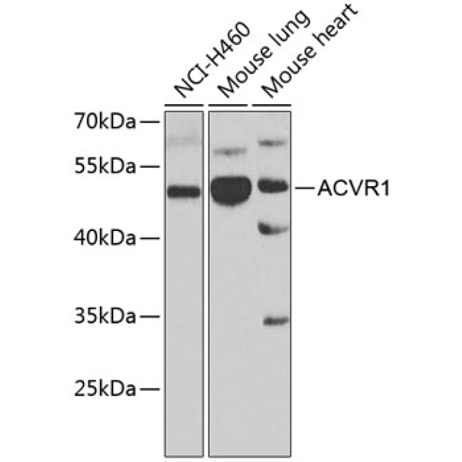 ACVR1 Rabbit Polyclonal Antibody