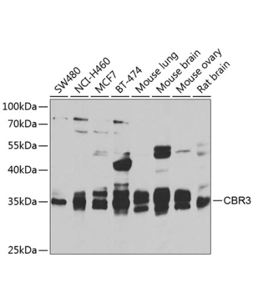 CBR3 Rabbit Polyclonal Antibody