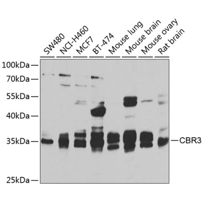 CBR3 Rabbit Polyclonal Antibody