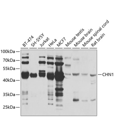 CHN1 Rabbit Polyclonal Antibody