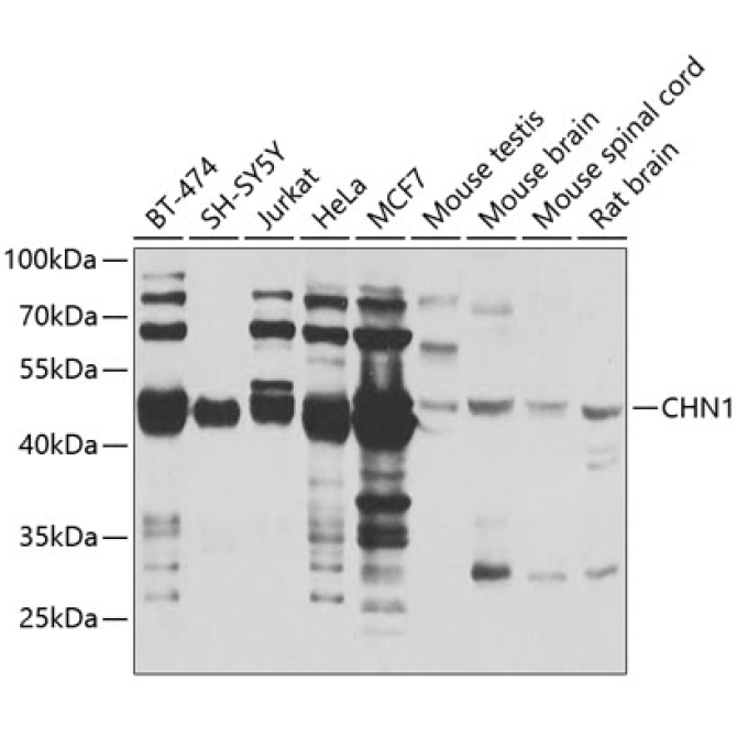 CHN1 Rabbit Polyclonal Antibody