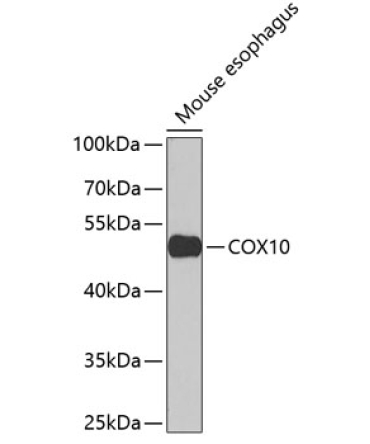 COX10 Rabbit Polyclonal Antibody