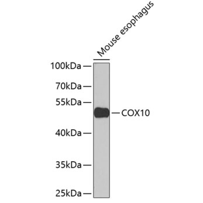COX10 Rabbit Polyclonal Antibody