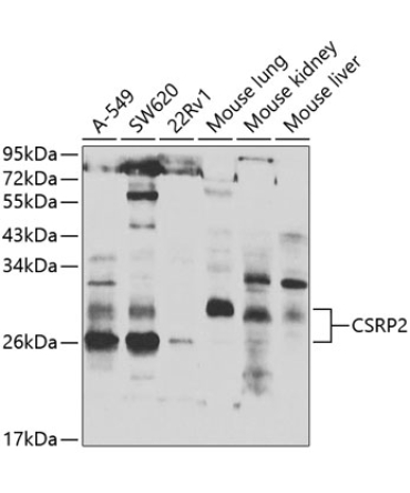 CSRP2 Rabbit Polyclonal Antibody
