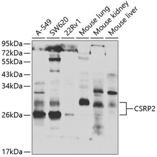 CSRP2 Rabbit Polyclonal Antibody