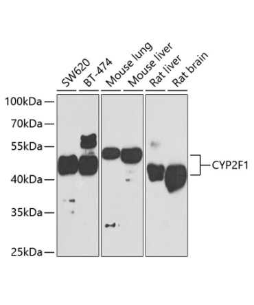 CYP2F1 Rabbit Polyclonal Antibody
