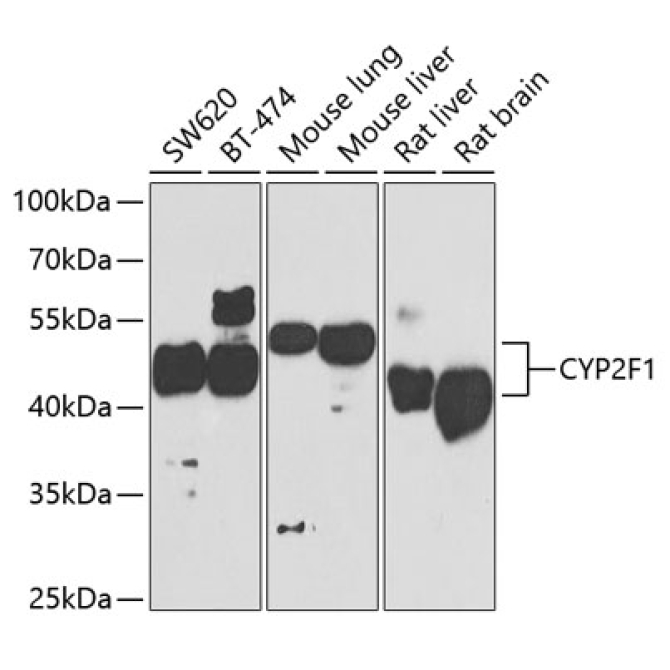 CYP2F1 Rabbit Polyclonal Antibody