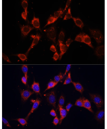 DVL2 Rabbit Polyclonal Antibody
