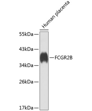 FCGR2B Rabbit Polyclonal Antibody