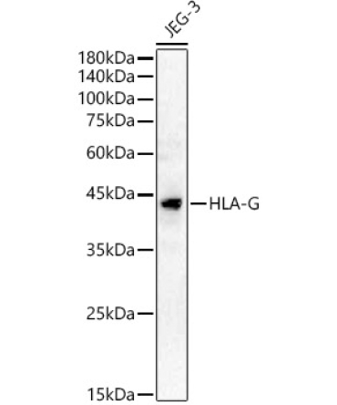 HLA-G Rabbit Polyclonal Antibody