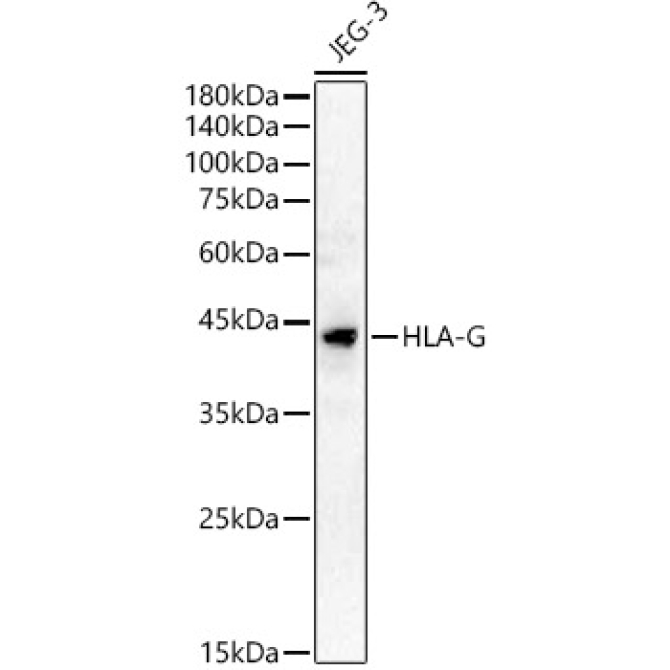 HLA-G Rabbit Polyclonal Antibody