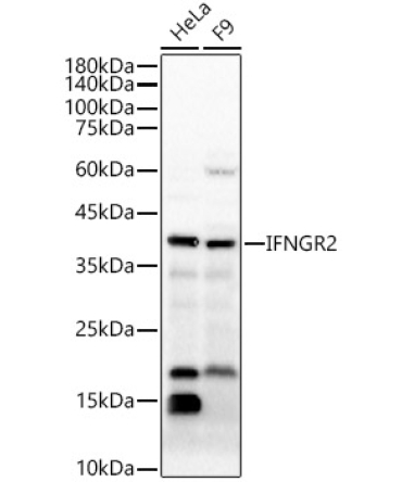 IFNGR2 Rabbit Polyclonal Antibody