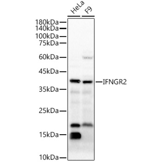 IFNGR2 Rabbit Polyclonal Antibody