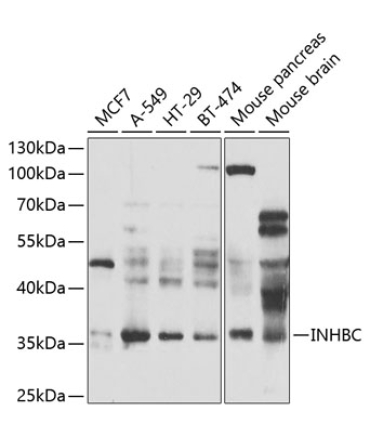 INHBC Rabbit Polyclonal Antibody