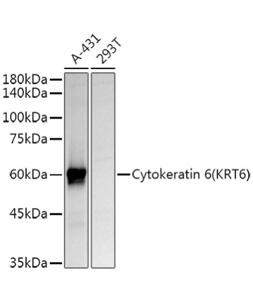 Cytokeratin 6 (KRT6) Rabbit Polyclonal Antibody