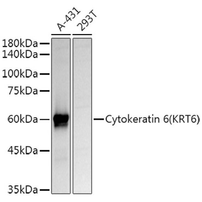 Cytokeratin 6 (KRT6) Rabbit Polyclonal Antibody
