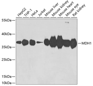 MDH1 Rabbit Polyclonal Antibody