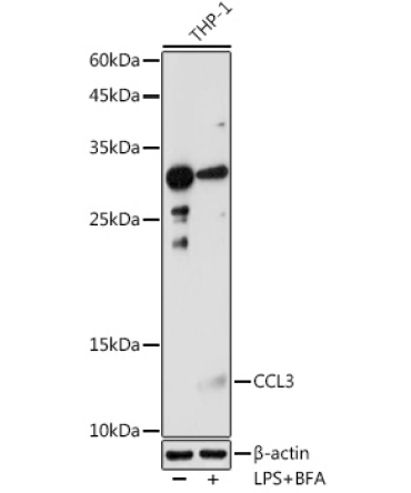 CCL3 Rabbit Polyclonal Antibody