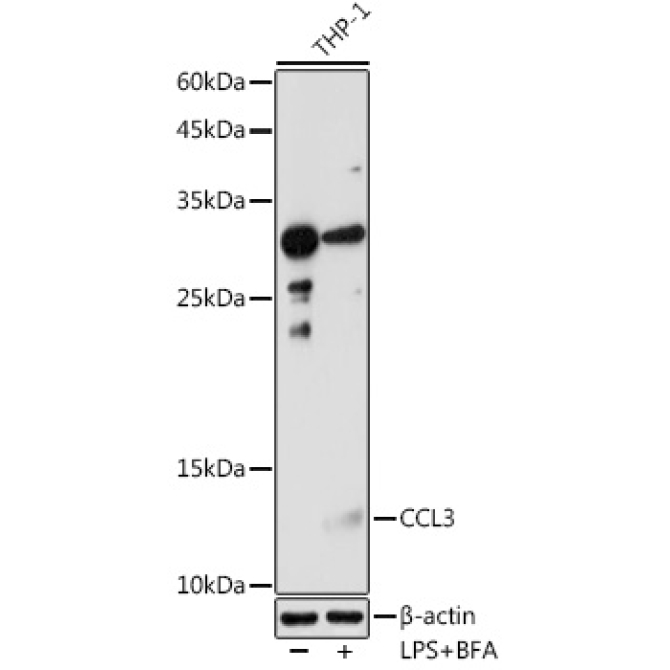 CCL3 Rabbit Polyclonal Antibody