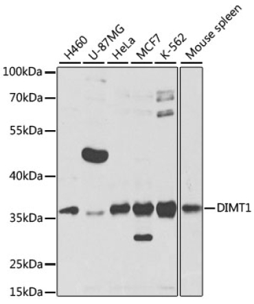 DIMT1 Rabbit Polyclonal Antibody