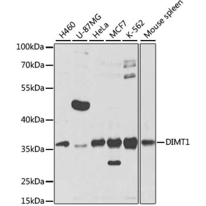 DIMT1 Rabbit Polyclonal Antibody