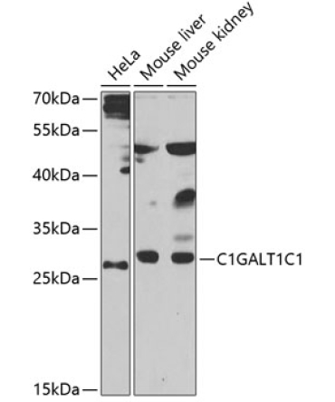 C1GALT1C1 Rabbit Polyclonal Antibody