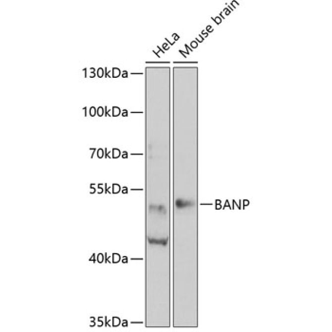 BANP Rabbit Polyclonal Antibody
