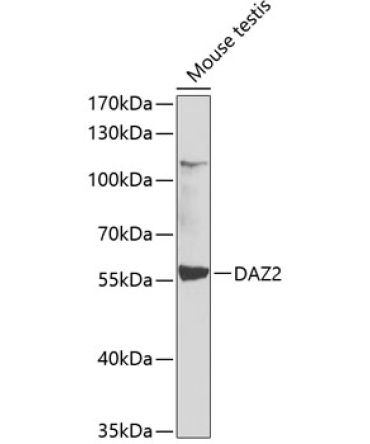 DAZ2 Rabbit Polyclonal Antibody