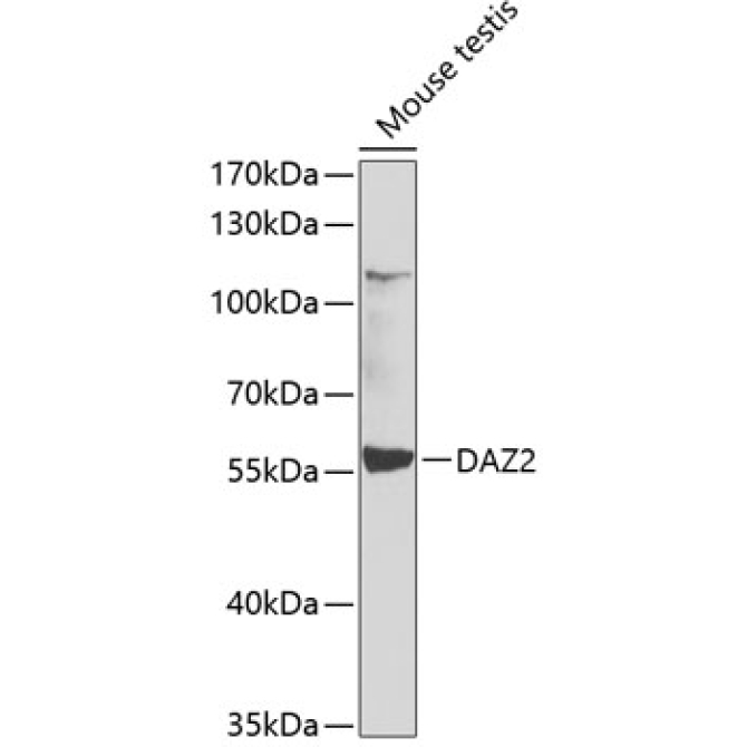 DAZ2 Rabbit Polyclonal Antibody