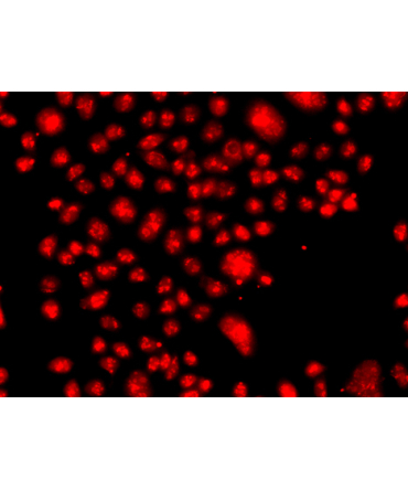 FANCM Rabbit Polyclonal Antibody