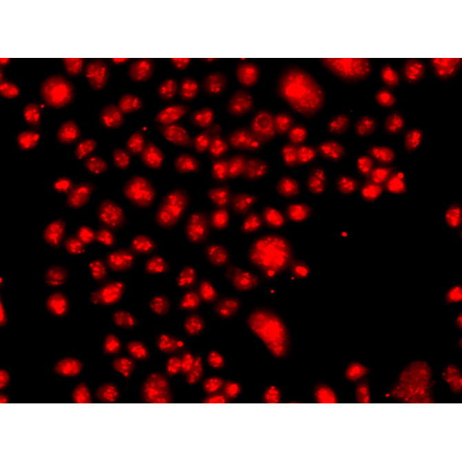 FANCM Rabbit Polyclonal Antibody