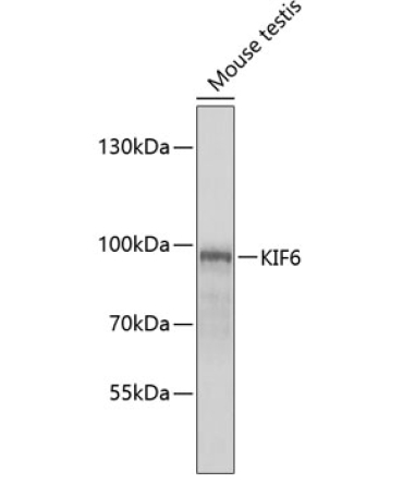 KIF6 Rabbit Polyclonal Antibody