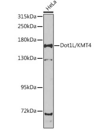Dot1L/KMT4 Rabbit Polyclonal Antibody