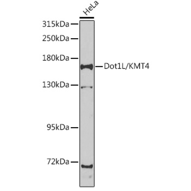 Dot1L/KMT4 Rabbit Polyclonal Antibody