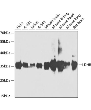 LDHB Rabbit Polyclonal Antibody