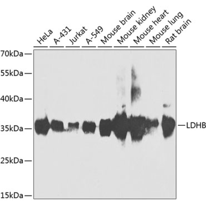LDHB Rabbit Polyclonal Antibody