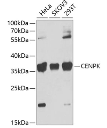 CENPK Rabbit Polyclonal Antibody