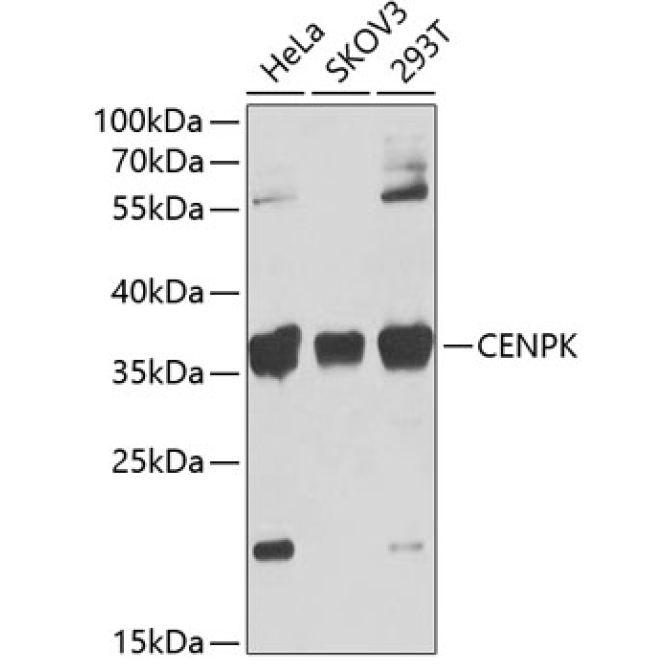 CENPK Rabbit Polyclonal Antibody