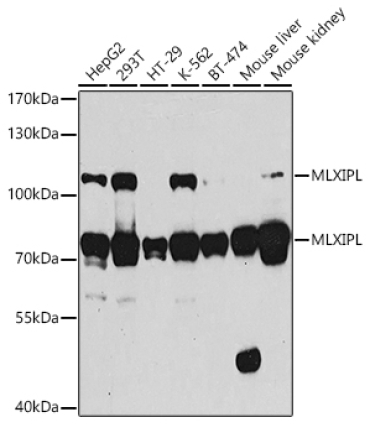 MLXIPL Rabbit Polyclonal Antibody