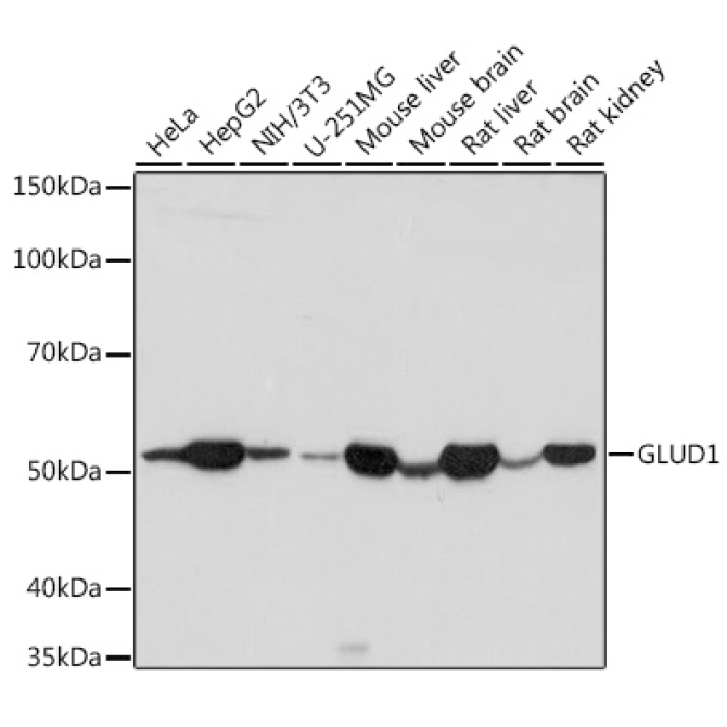 GLUD1 Rabbit Polyclonal Antibody