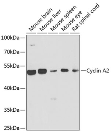 Cyclin A2 Rabbit Polyclonal Antibody