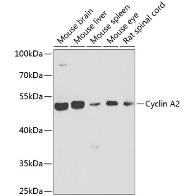 Cyclin A2 Rabbit Polyclonal Antibody