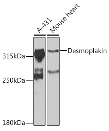 Desmoplakin Rabbit Polyclonal Antibody